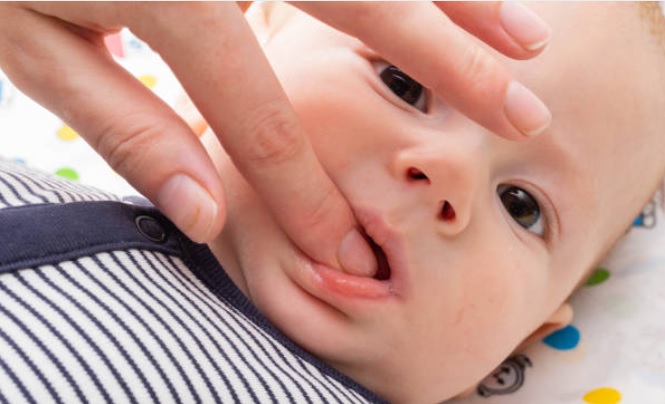 12 Safe and Soothing Home Remedies for Baby Teething Relief